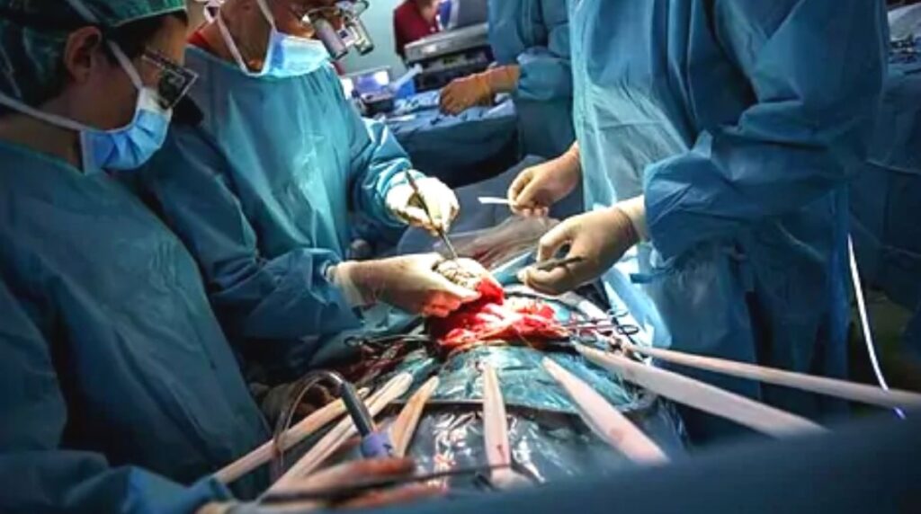 surgeons perform a transplant